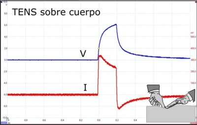 TENS sobre cuerpo