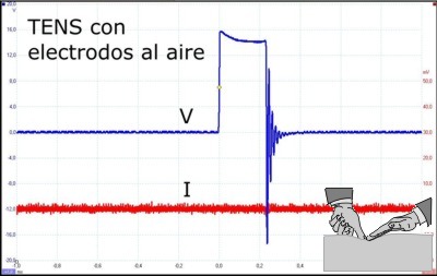 TENS al aire