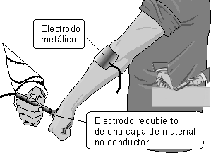 Monopolar puntual