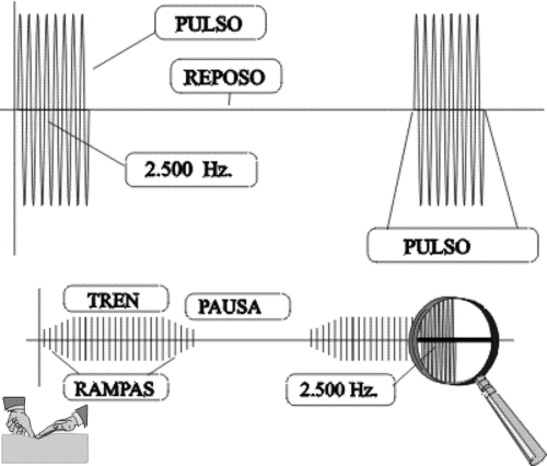 Electroestimulación muscular, parámetros: la Frecuencia (Hz) -  ®